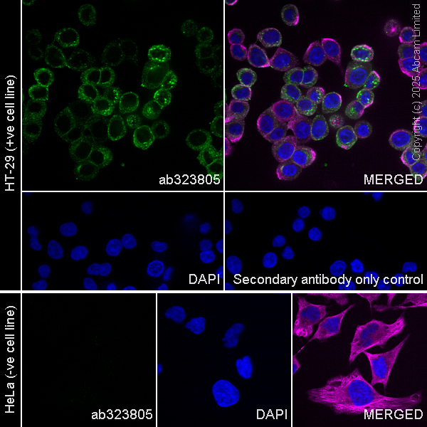 Immunocytochemistry/ Immunofluorescence - Anti-CEACAM1+ CEACAM5 + CEACAM6 + CEACAM8 antibody  [RM1195] (AB323805), expandable thumbnail