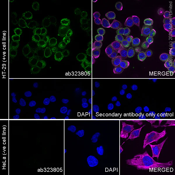 Immunocytochemistry/ Immunofluorescence - Anti-CEACAM1+ CEACAM5 + CEACAM6 + CEACAM8 antibody [RM1195] (AB323805)