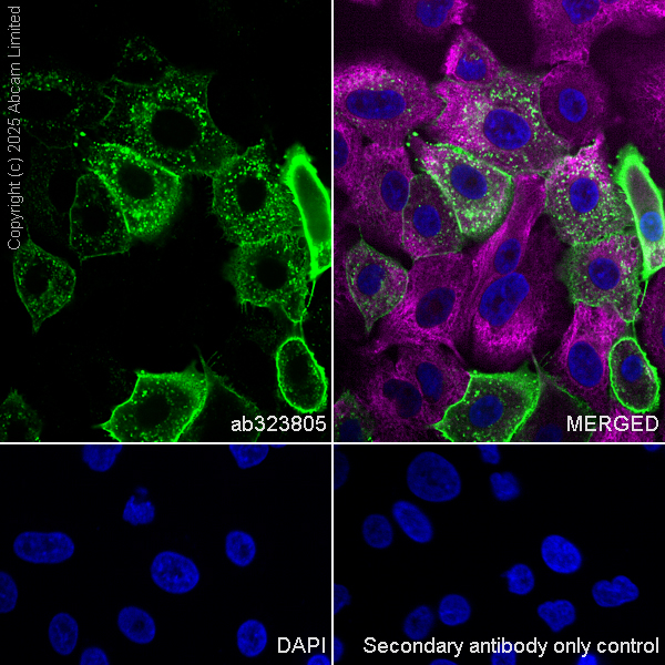 Immunocytochemistry/ Immunofluorescence - Anti-CEACAM1+ CEACAM5 + CEACAM6 + CEACAM8 antibody  [RM1195] (AB323805), expandable thumbnail