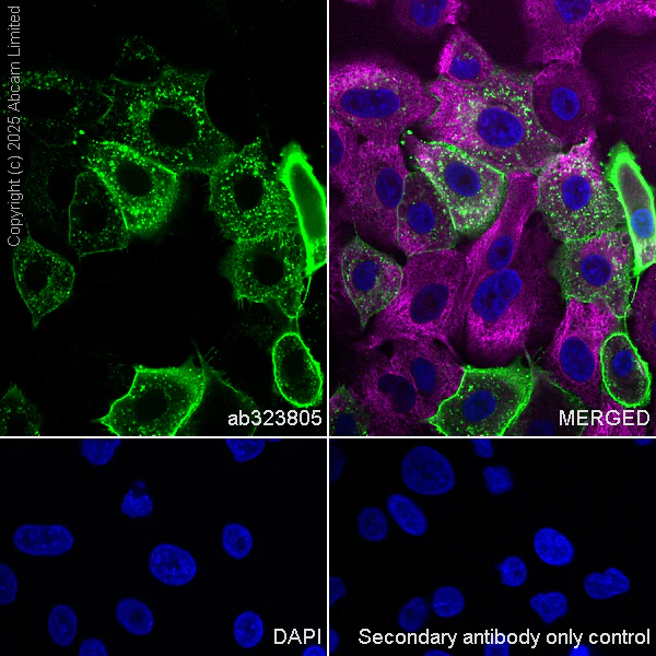 Immunocytochemistry/ Immunofluorescence - Anti-CEACAM1+ CEACAM5 + CEACAM6 + CEACAM8 antibody [RM1195] (AB323805)