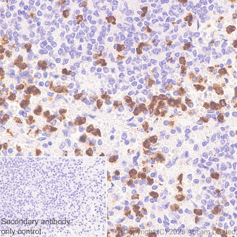 Immunohistochemistry (Formalin/PFA-fixed paraffin-embedded sections) - Anti-CEACAM1+ CEACAM5 + CEACAM6 + CEACAM8 antibody  [RM1195] (ab323805), expandable thumbnail