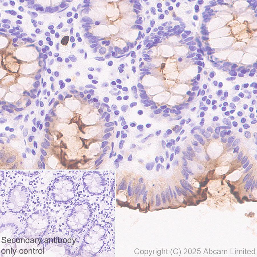 Immunohistochemistry (Formalin/PFA-fixed paraffin-embedded sections) - Anti-CEACAM1+ CEACAM5 + CEACAM6 + CEACAM8 antibody  [RM1195] (ab323805), expandable thumbnail