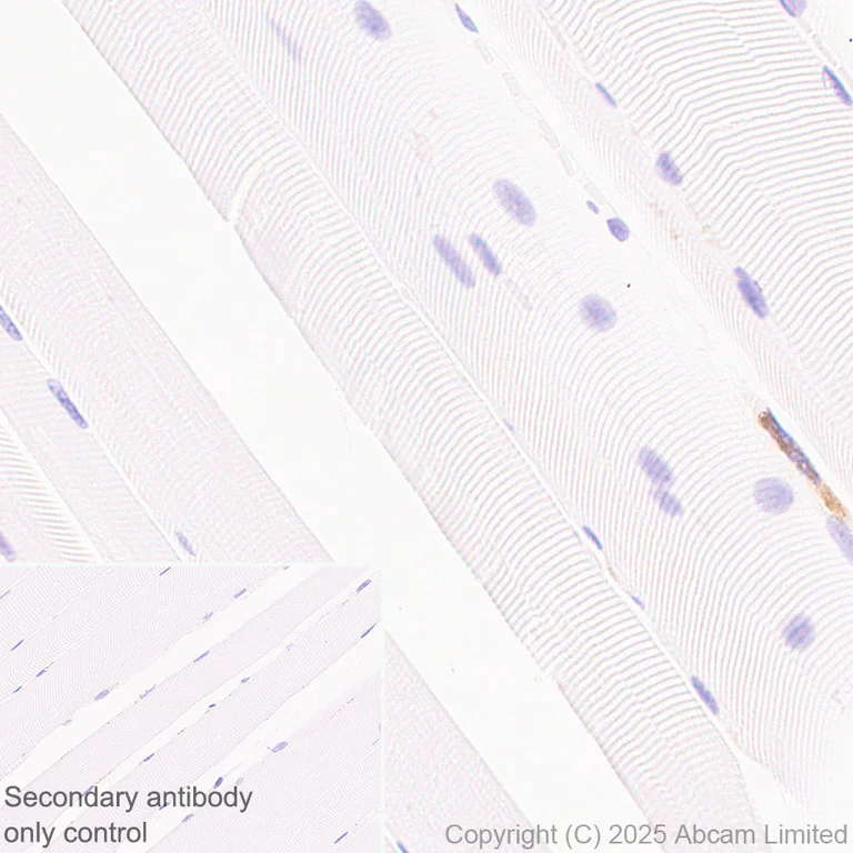 Immunohistochemistry (Formalin/PFA-fixed paraffin-embedded sections) - Anti-CEACAM1+ CEACAM5 + CEACAM6 + CEACAM8 antibody [RM1195] (AB323805)