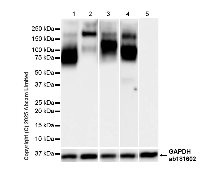 Western blot - Anti-CEACAM1+ CEACAM5 + CEACAM6 + CEACAM8 antibody [RM1195] (AB323805)