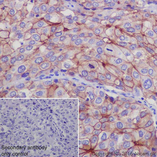 Immunohistochemistry (Formalin/PFA-fixed paraffin-embedded sections) - Anti-CEACAM1 + CEACAM6 antibody [EPR19878] (AB206431)