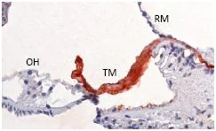 Immunohistochemistry (Formalin/PFA-fixed paraffin-embedded sections) - Anti-CEACAM16 antibody [SU-9D5] (AB167477)