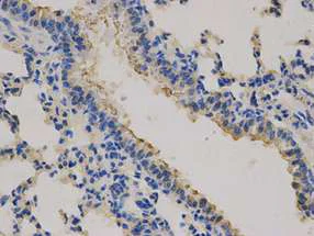 Immunohistochemistry (Formalin/PFA-fixed paraffin-embedded sections) - Anti-CEACAM3 antibody (AB196606)