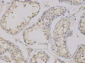 Immunohistochemistry (Formalin/PFA-fixed paraffin-embedded sections) - Anti-CEACAM3 antibody (AB196606)