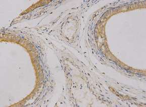Immunohistochemistry (Formalin/PFA-fixed paraffin-embedded sections) - Anti-CEACAM3 antibody (AB196606)