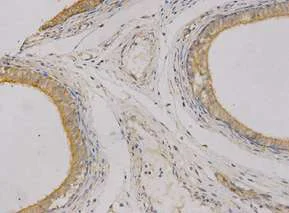 Immunohistochemistry (Formalin/PFA-fixed paraffin-embedded sections) - Anti-CEACAM3 antibody (AB196606)