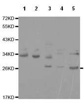 Western blot - Anti-CEACAM3 antibody (AB196606)