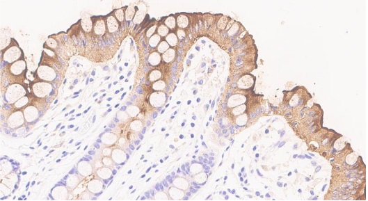 Immunohistochemistry (Formalin/PFA-fixed paraffin-embedded sections) - Anti-CEACAM5 antibody [26/3/13] - BSA and Azide free (AB4451)