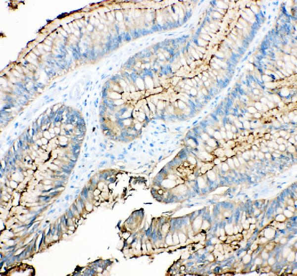 Immunohistochemistry (Formalin/PFA-fixed paraffin-embedded sections) - Anti-CEACAM5 antibody (AB131070)