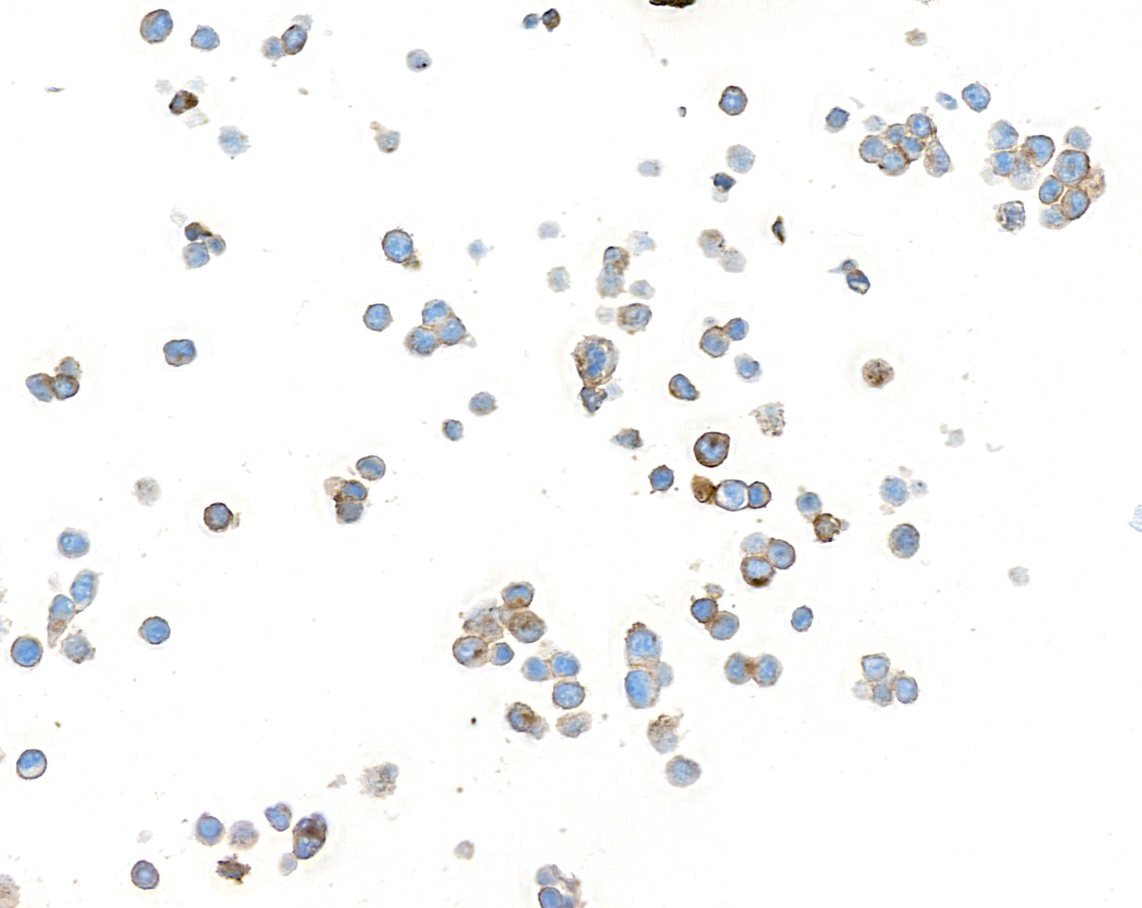 Immunocytochemistry - Anti-CEACAM5 antibody [BLR198J] - BSA free (AB314055), expandable thumbnail