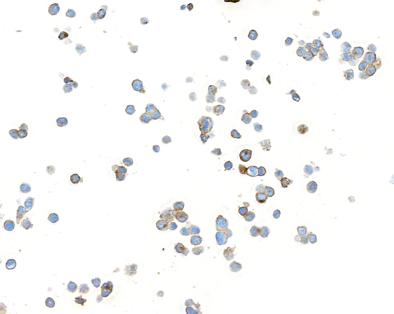 Immunocytochemistry - Anti-CEACAM5 antibody [BLR198J] - BSA free (AB314055)