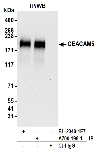 Immunoprecipitation - Anti-CEACAM5 antibody [BLR198J] - BSA free (AB314055)