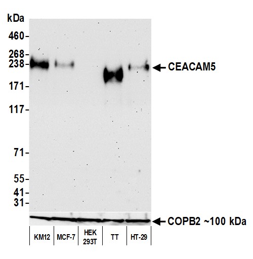 Western blot - Anti-CEACAM5 antibody [BLR198J] - BSA free (AB314055), expandable thumbnail
