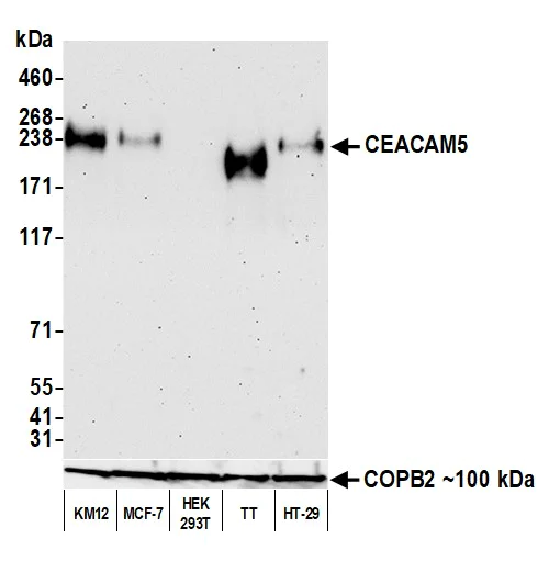 Western blot - Anti-CEACAM5 antibody [BLR198J] - BSA free (AB314055)