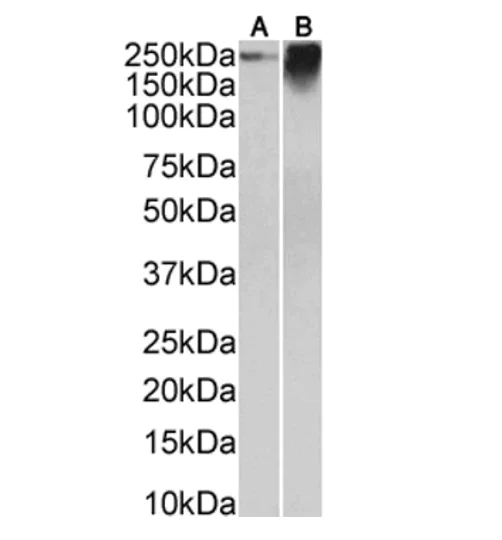 Western blot - Anti-CEACAM5 Antibody [CB30] (AB316349)