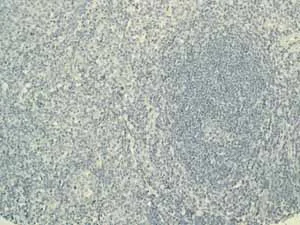 Immunohistochemistry (Formalin/PFA-fixed paraffin-embedded sections) - Anti-CEACAM5 antibody [EPCEAR7] (AB133633)