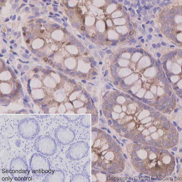 Immunohistochemistry (Formalin/PFA-fixed paraffin-embedded sections) - Anti-CEACAM5 antibody [EPCEAR7] (AB133633)