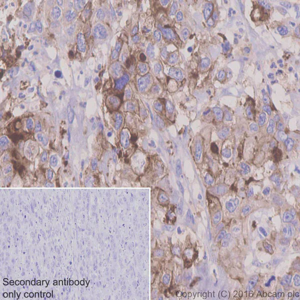 Immunohistochemistry (Formalin/PFA-fixed paraffin-embedded sections) - Anti-CEACAM5 antibody [EPCEAR7] (AB133633)