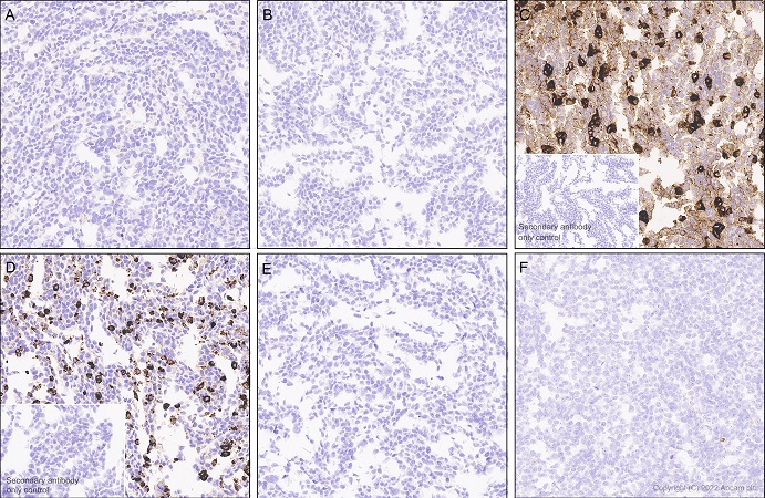 Immunohistochemistry (Formalin/PFA-fixed paraffin-embedded sections) - Anti-CEACAM5 antibody [EPCEAR7] (AB133633)