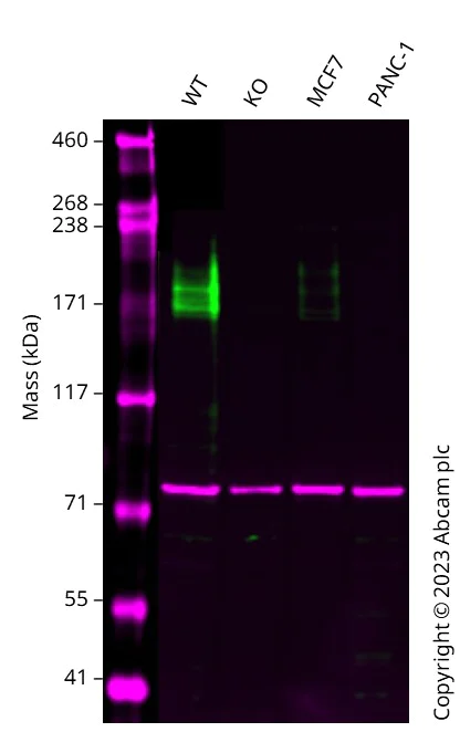 Western blot - Anti-CEACAM5 antibody [EPCEAR7] (AB133633)