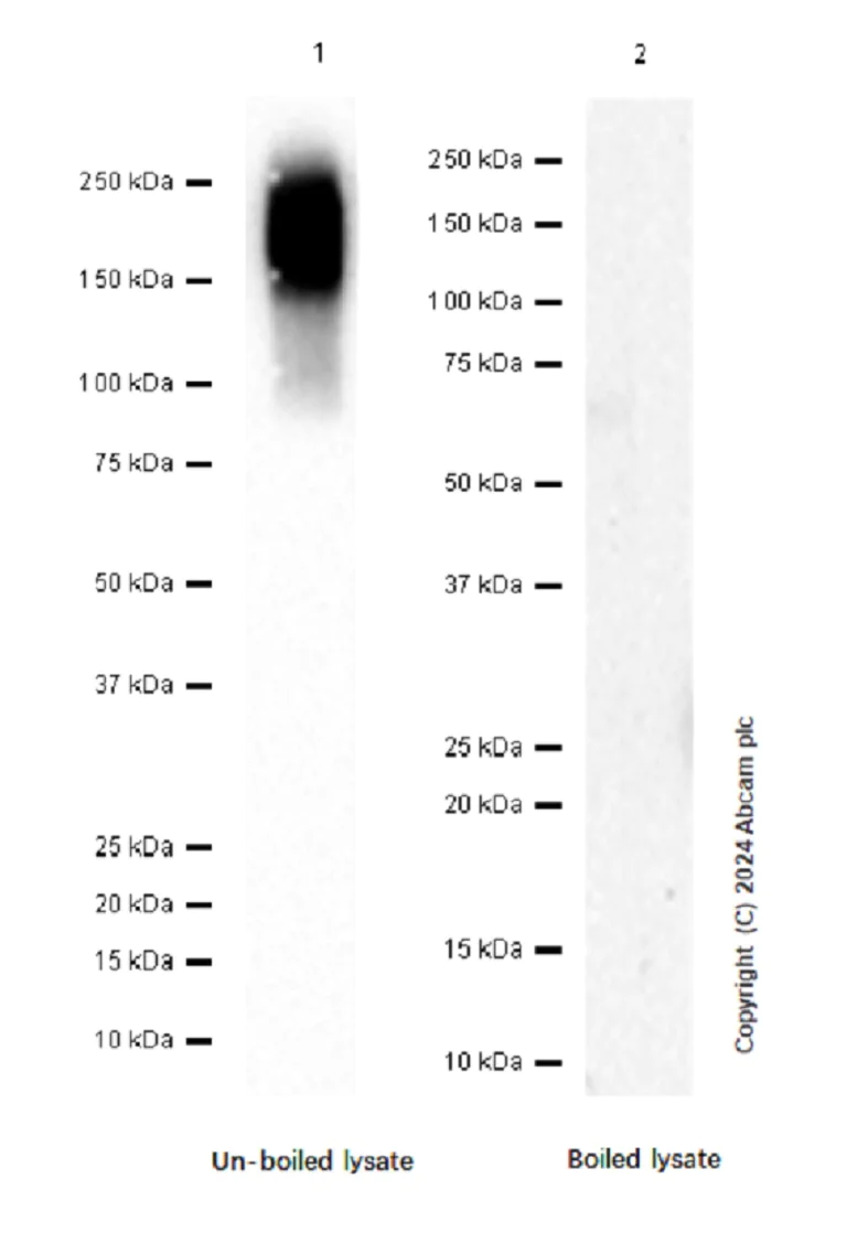 Western blot - Anti-CEACAM5 antibody [EPCEAR7] (AB133633)