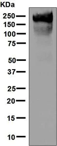 Western blot - Anti-CEACAM5 antibody [EPCEAR7] (AB133633)