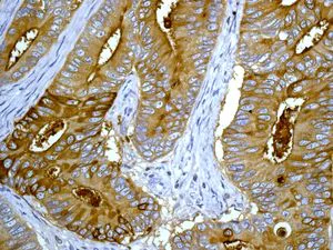 Immunohistochemistry (Formalin/PFA-fixed paraffin-embedded sections) - Anti-CEACAM5 antibody [EPCEAR7] - BSA and Azide free (AB226144)