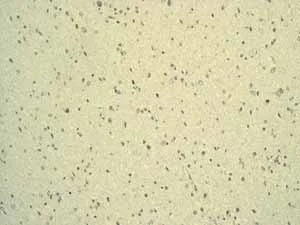 Immunohistochemistry (Formalin/PFA-fixed paraffin-embedded sections) - Anti-CEACAM5 antibody [EPCEAR7] - BSA and Azide free (AB226144)
