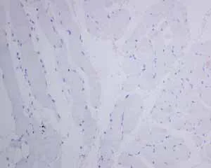 Immunohistochemistry (Formalin/PFA-fixed paraffin-embedded sections) - Anti-CEACAM5 antibody [EPCEAR7] - BSA and Azide free (AB226144)