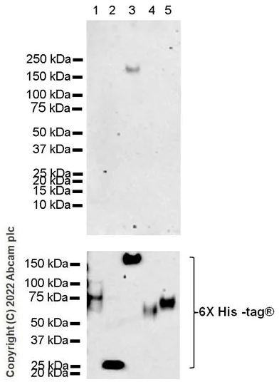 Western blot - Anti-CEACAM5 antibody [EPCEAR7] - BSA and Azide free (AB226144)