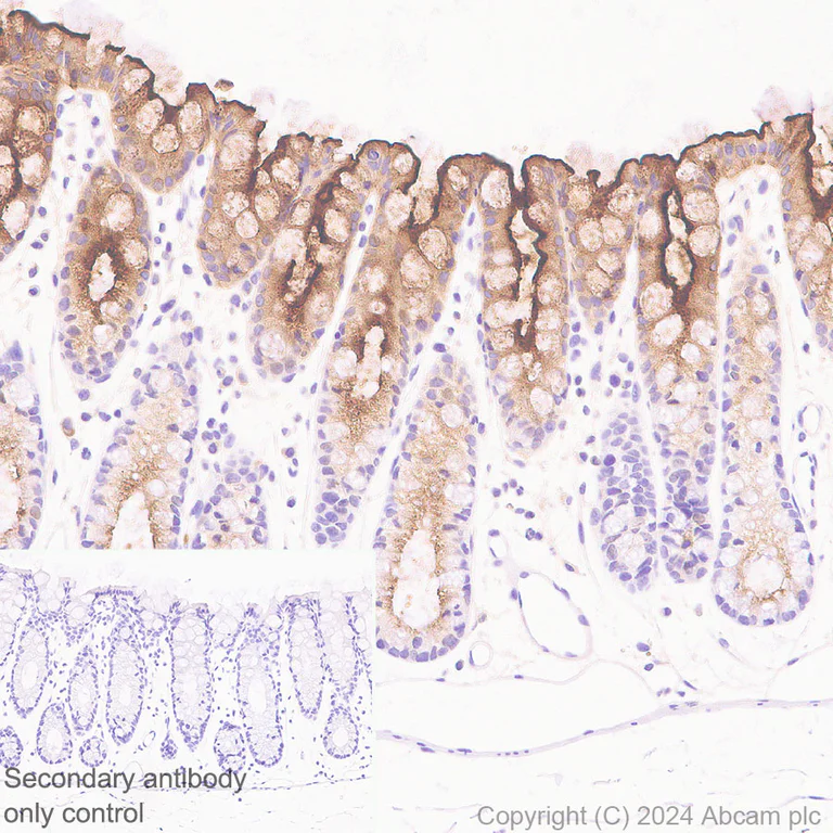 Immunohistochemistry (Formalin/PFA-fixed paraffin-embedded sections) - Anti-CEACAM5 antibody [EPR28723-86] (AB317618)