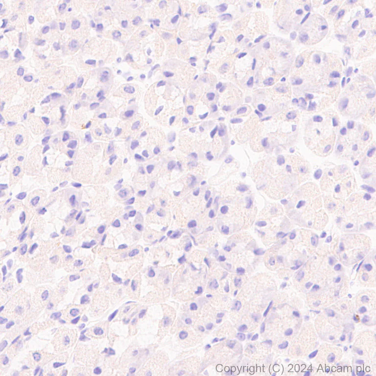 Immunohistochemistry (Formalin/PFA-fixed paraffin-embedded sections) - Anti-CEACAM5 antibody [EPR28723-86] (AB317618)