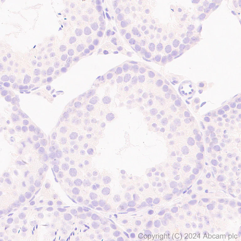 Immunohistochemistry (Formalin/PFA-fixed paraffin-embedded sections) - Anti-CEACAM5 antibody [EPR28723-86] (AB317618)