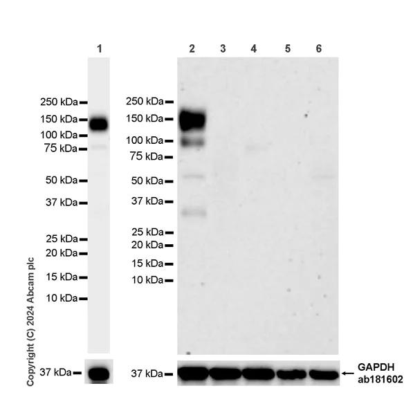 Western blot - Anti-CEACAM5 antibody [EPR28723-86] (AB317618)