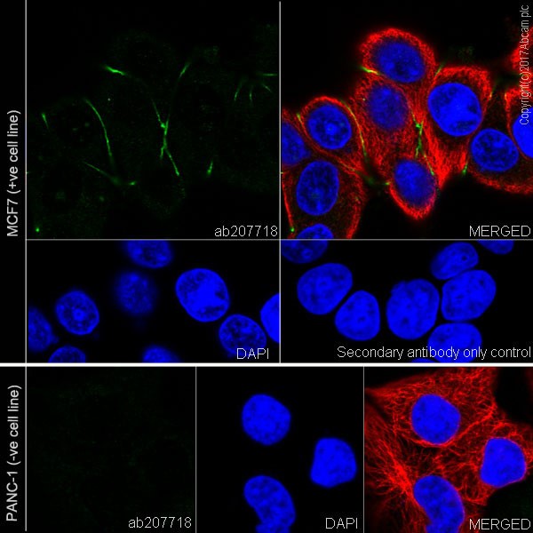 Anti-CEACAM5 + CD66b + CEACAM1 + CEACAM6 antibody [EPR20721] (ab207718 ...