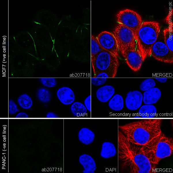 Immunocytochemistry/ Immunofluorescence - Anti-CEACAM5 + CD66b + CEACAM1 + CEACAM6 antibody [EPR20721] (AB207718)
