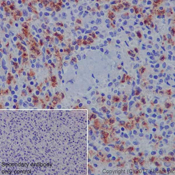 Immunohistochemistry (Formalin/PFA-fixed paraffin-embedded sections) - Anti-CEACAM5 + CD66b + CEACAM1 + CEACAM6 antibody [EPR20721] (AB207718)
