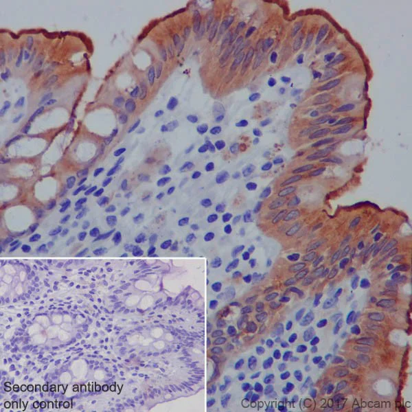 Immunohistochemistry (Formalin/PFA-fixed paraffin-embedded sections) - Anti-CEACAM5 + CD66b + CEACAM1 + CEACAM6 antibody [EPR20721] (AB207718)