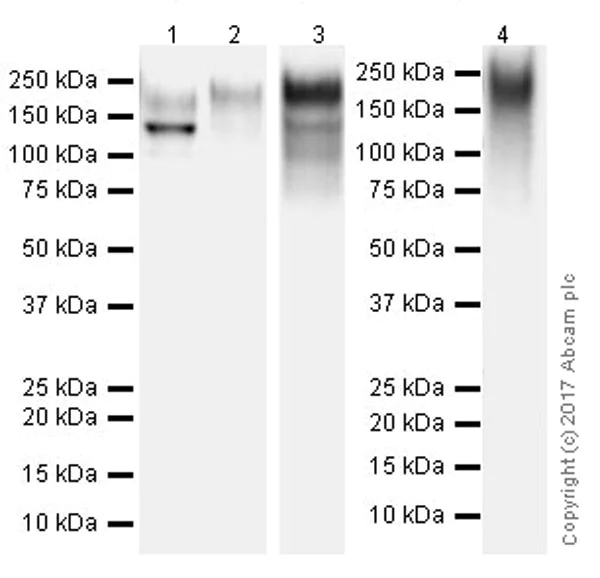 Western blot - Anti-CEACAM5 + CD66b + CEACAM1 + CEACAM6 antibody [EPR20721] (AB207718)
