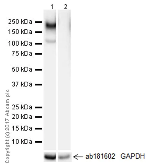 Western blot - Anti-CEACAM5 + CD66b + CEACAM1 + CEACAM6 antibody [EPR20721] (AB207718)