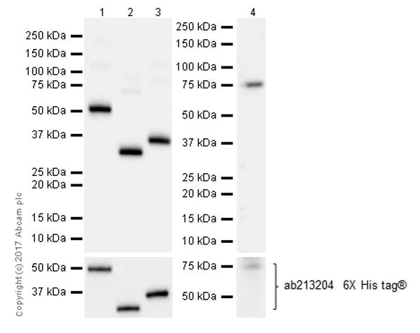 Western blot - Anti-CEACAM5 + CD66b + CEACAM1 + CEACAM6 antibody [EPR20721] (AB207718)