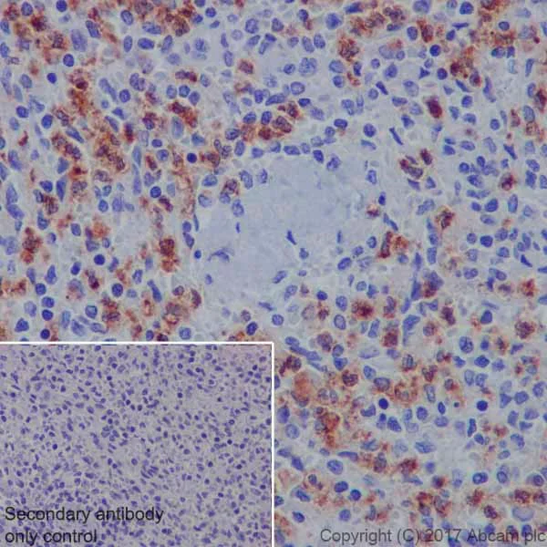 Immunohistochemistry (Formalin/PFA-fixed paraffin-embedded sections) - Anti-CEACAM5 + CD66b + CEACAM1 + CEACAM6 antibody [EPR20721] - BSA and Azide free (AB229074)