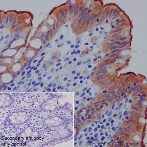 Immunohistochemistry (Formalin/PFA-fixed paraffin-embedded sections) - Anti-CEACAM5 + CD66b + CEACAM1 + CEACAM6 antibody [EPR20721] - BSA and Azide free (AB229074)