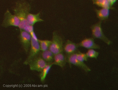 Immunocytochemistry/ Immunofluorescence - Anti-CEACAM5 + CEACAM6 antibody [NCRC16 (AKA 161)] (AB22705)