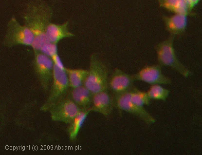 Immunocytochemistry/ Immunofluorescence - Anti-CEACAM5 + CEACAM6 antibody [NCRC16 (AKA 161)] (AB22705)