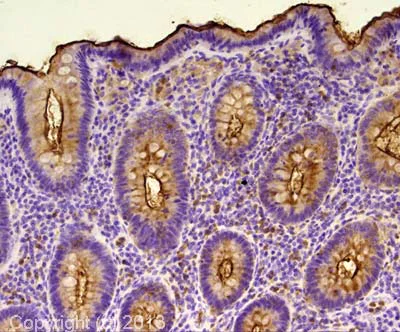 Immunohistochemistry (Formalin/PFA-fixed paraffin-embedded sections) - Anti-CEACAM5 + CEACAM6 antibody [NCRC16 (AKA 161)] (AB22705)